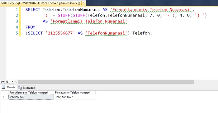 SQL Server’da STUFF Fonksiyonu ile Telefon Formatlamak