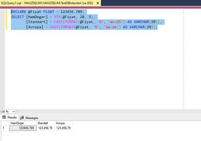 SQL Server'da Rakamsal Değerleri Ayırmak